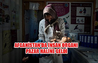 Afganistan'da insan organı pazar haline geldi