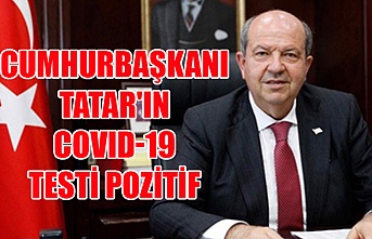 Cumhurbaşkanı Tatar'ın covid-19 testi pozitif