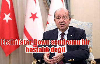 Ersin Tatar, Down sendromu bir hastalık değil