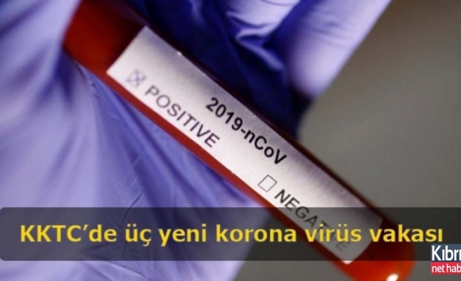 KKTC’de üç yeni korona virüs vakası
