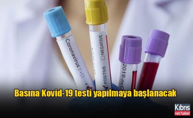 Basın mensuplarına da Kovid-19 testi yapılmaya başlanacak