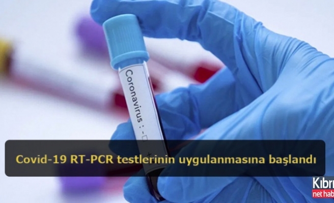 Gazimağusa'da Covid-19 RT-PCR testlerinin uygulanmasına başlandı