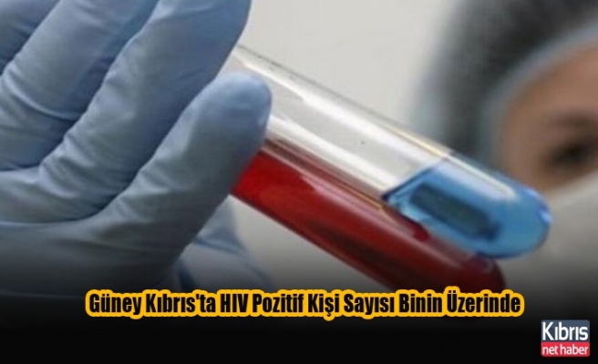 Güney Kıbrıs'ta HIV Pozitif Kişi Sayısı Binin Üzerinde