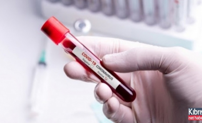 Koronavirüse karşı en riskli kan grubu belirlendi