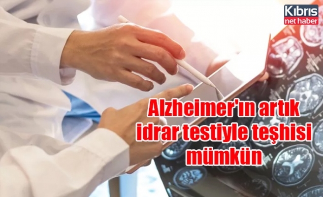 Alzheimer'ın artık idrar testiyle teşhisi mümkün